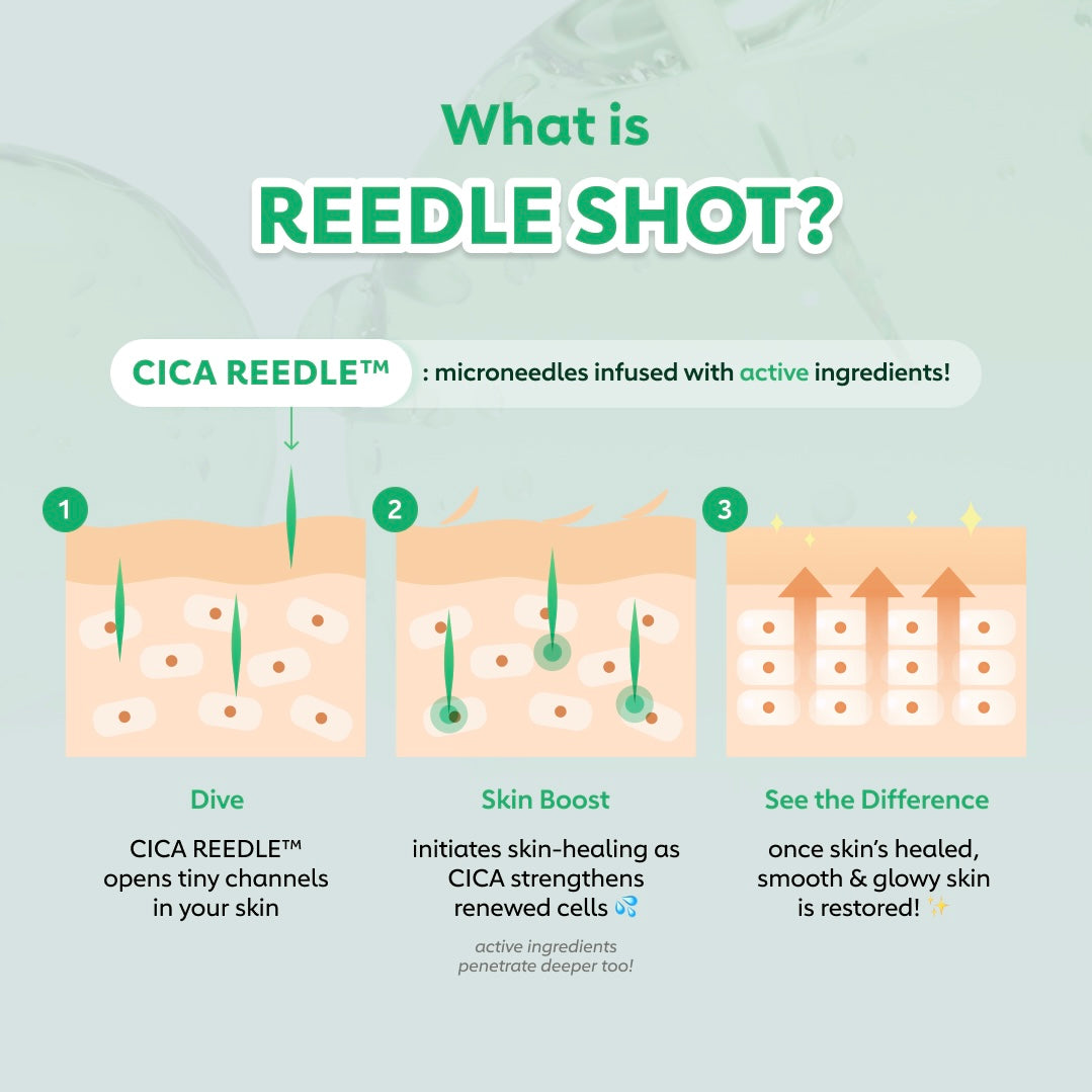 Reedle Shot 300