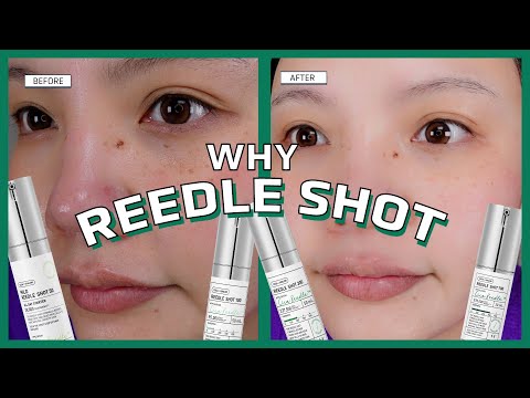 Reedle Shot 300