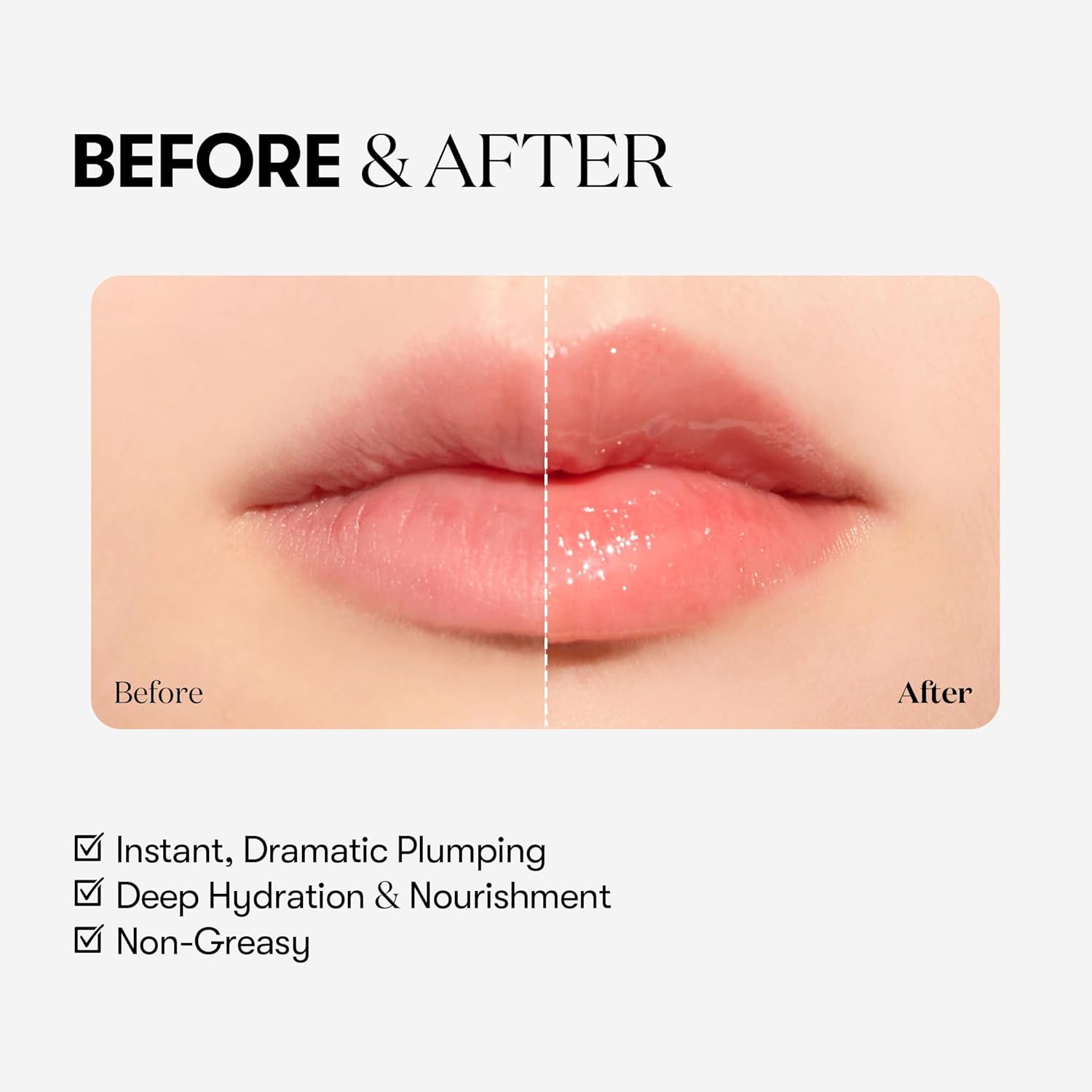 Reedle Shot Lip Plumper [#Expert]