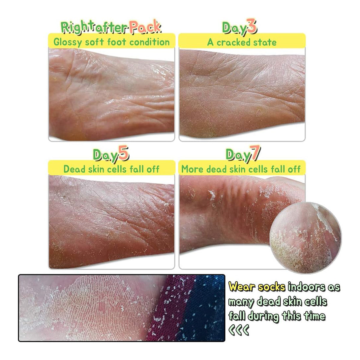 Witch Piggy Hell-Pore Turtle’s Foot Pack