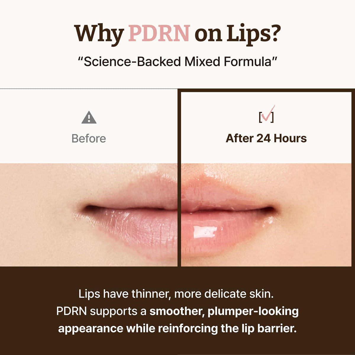 Advanced PDRN Rejuvenating Lip Serum